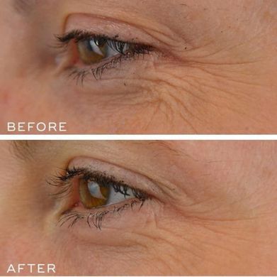 Medik8 Crystal Retinal Ceramide Eye 6