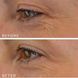 Medik8 Crystal Retinal Ceramide Eye 6